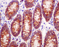 Immunohistochemistry (Formalin/PFA-fixed paraffin-embedded sections) - Anti-GARS antibody [EPR7157] - BSA and Azide free (AB248097)