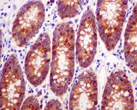 Immunohistochemistry (Formalin/PFA-fixed paraffin-embedded sections) - Anti-GARS antibody [EPR7157] - BSA and Azide free (AB248097)