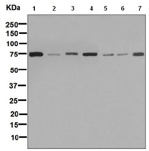 Western blot - Anti-GARS antibody [EPR7157] - BSA and Azide free (AB248097)