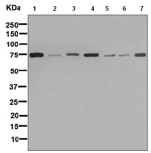 Western blot - Anti-GARS antibody [EPR7157] - BSA and Azide free (AB248097)