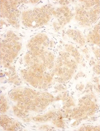 Immunohistochemistry (Formalin/PFA-fixed paraffin-embedded sections) - Anti-GART antibody (AB187716)