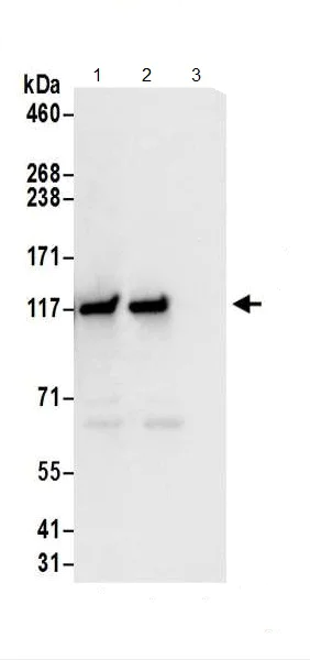Immunoprecipitation - Anti-GART antibody (AB187716)
