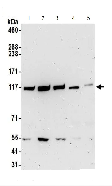 Western blot - Anti-GART antibody (AB187716)