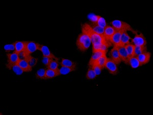 Immunocytochemistry/ Immunofluorescence - Anti-GART antibody [EPR11622] (AB169550), expandable thumbnail