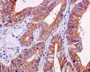 Immunohistochemistry (Formalin/PFA-fixed paraffin-embedded sections) - Anti-GART antibody [EPR11622] (AB169550)