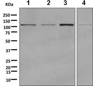 Western blot - Anti-GART antibody [EPR11622] (AB169550)