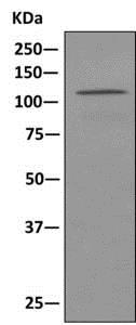 Western blot - Anti-GART antibody [EPR11622] (ab169550), expandable thumbnail