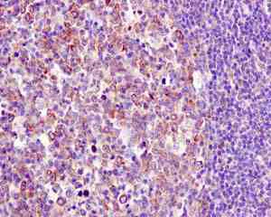 Immunohistochemistry (Formalin/PFA-fixed paraffin-embedded sections) - Anti-GART antibody [EPR11622] - BSA and Azide free (AB249500)
