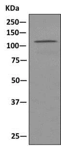 Western blot - Anti-GART antibody [EPR11622] - BSA and Azide free (AB249500)