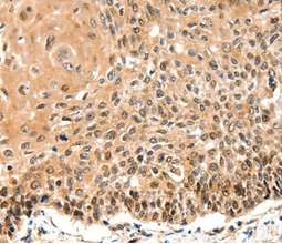 Immunohistochemistry (Formalin/PFA-fixed paraffin-embedded sections) - Anti-GAS 6 antibody (AB198027)