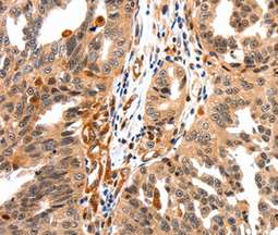 Immunohistochemistry (Formalin/PFA-fixed paraffin-embedded sections) - Anti-GAS 6 antibody (AB198027)