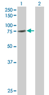 Western blot - Anti-GAS 6 antibody (AB67099)