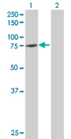 Western blot - Anti-GAS 6 antibody (AB67099)