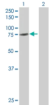 Western blot - GAS 6 overexpression 293T lysate (whole cell) (AB94148)