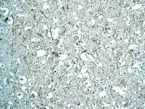 Immunohistochemistry (Formalin/PFA-fixed paraffin-embedded sections) - Anti-GAS-7 antibody [EPR11129(B)] (AB168370)