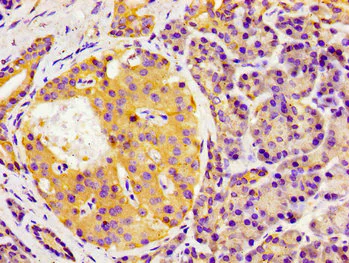 Immunohistochemistry (Formalin/PFA-fixed paraffin-embedded sections) - Anti-Gas1 antibody (AB236618)