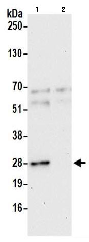 Immunoprecipitation - Anti-GAS41 antibody (AB205018)