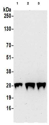 Western blot - Anti-GAS41 antibody (AB205018)