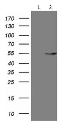 Western blot - Anti-GAS8 antibody [OTI10G2] (AB236386)