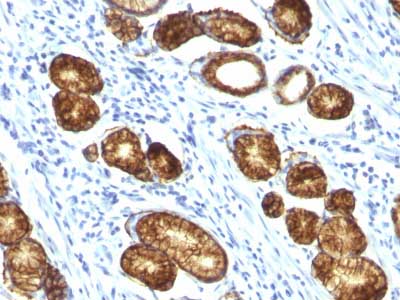 Immunohistochemistry (Formalin/PFA-fixed paraffin-embedded sections) - Anti-Gastric Mucin/MUC-6 antibody [MUC6/916] - BSA and Azide free (AB212648), expandable thumbnail