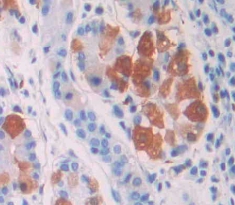 Immunohistochemistry (Formalin/PFA-fixed paraffin-embedded sections) - Anti-Gastrin antibody (AB232775)