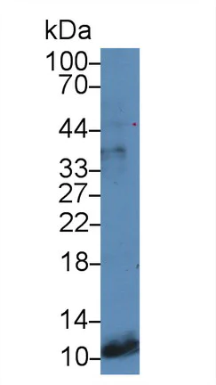 Western blot - Anti-Gastrin antibody (AB232775)