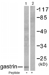 Western blot - Anti-Gastrin antibody (AB53085)