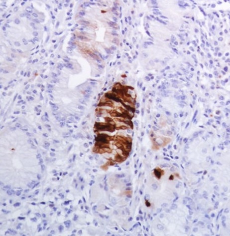 Immunohistochemistry (Formalin/PFA-fixed paraffin-embedded sections) - Anti-Gastrin antibody [SP318] (AB223501), expandable thumbnail