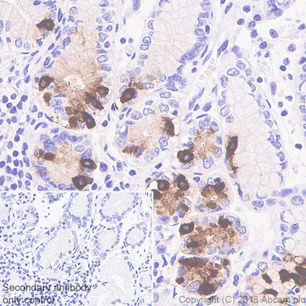 Immunohistochemistry (Formalin/PFA-fixed paraffin-embedded sections) - Anti-Gastrin antibody [SP318] (AB223501), expandable thumbnail