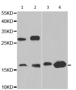 Western blot - Anti-Gastrin Releasing Peptide antibody (AB202123)
