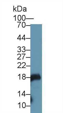 Western blot - Anti-Gastrokine 1 antibody (AB230990), expandable thumbnail