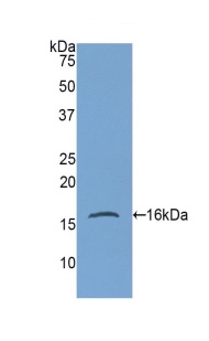 Western blot - Anti-Gastrokine 1 antibody (AB230990), expandable thumbnail