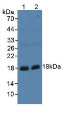 Western blot - Anti-Gastrokine 1 antibody (AB231952)
