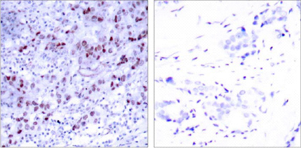 Immunohistochemistry (Formalin/PFA-fixed paraffin-embedded sections) - Anti-GATA1 antibody (AB28839)
