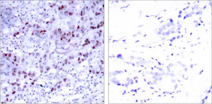 Immunohistochemistry (Formalin/PFA-fixed paraffin-embedded sections) - Anti-GATA1 antibody (AB28839)