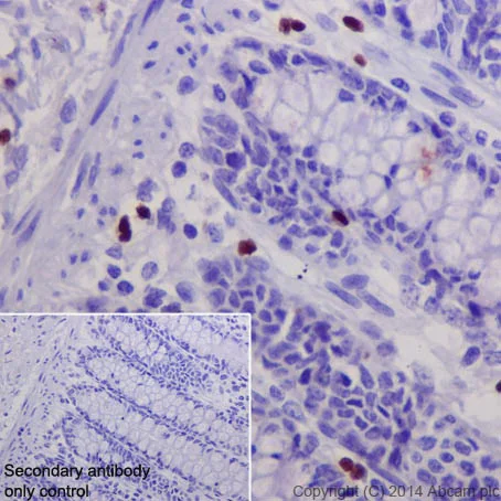Immunohistochemistry (Formalin/PFA-fixed paraffin-embedded sections) - Anti-GATA1 antibody [EPR17362] - ChIP Grade (AB181544)