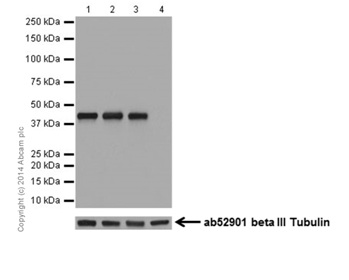 Western blot - Anti-GATA1 antibody [EPR17362] - ChIP Grade (AB181544)