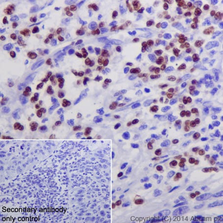 Immunohistochemistry (Formalin/PFA-fixed paraffin-embedded sections) - Anti-GATA1 antibody [EPR17362] - ChIP Grade - BSA and Azide free (AB241393)