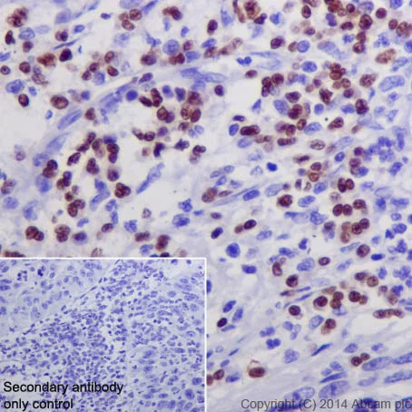Immunohistochemistry (Formalin/PFA-fixed paraffin-embedded sections) - Anti-GATA1 antibody [EPR17362] - ChIP Grade - BSA and Azide free (AB241393)