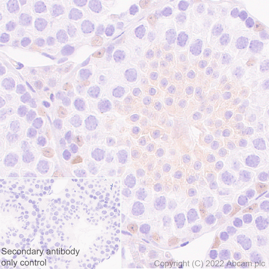 Immunohistochemistry (Formalin/PFA-fixed paraffin-embedded sections) - Anti-GATA1 antibody [EPR26488-109] (AB300613)