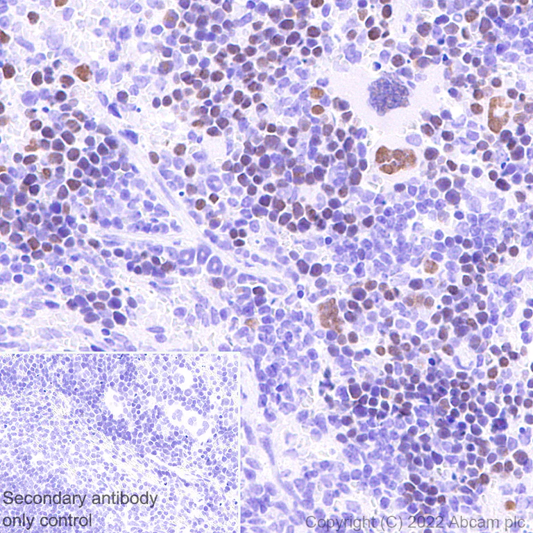 Immunohistochemistry (Formalin/PFA-fixed paraffin-embedded sections) - Anti-GATA1 antibody [EPR26488-109] (BSA and Azide free) (AB300614)