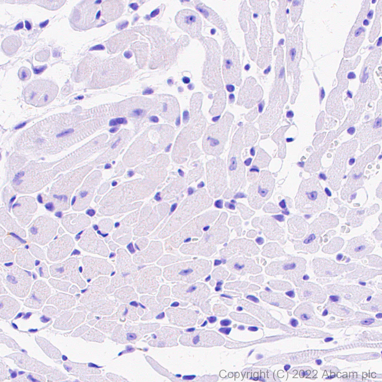 Immunohistochemistry (Formalin/PFA-fixed paraffin-embedded sections) - Anti-GATA1 antibody [EPR26488-109] (BSA and Azide free) (AB300614)