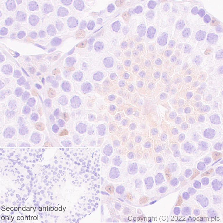 Immunohistochemistry (Formalin/PFA-fixed paraffin-embedded sections) - Anti-GATA1 antibody [EPR26488-109] (BSA and Azide free) (AB300614)
