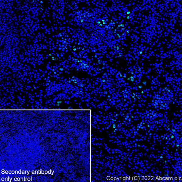 Immunohistochemistry (Frozen sections) - Anti-GATA1 antibody [EPR26488-109] (BSA and Azide free) (AB300614)
