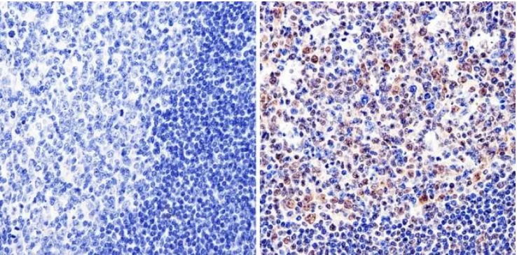 Immunohistochemistry (Formalin/PFA-fixed paraffin-embedded sections) - Anti-GATA1 antibody - N-terminal (AB173816)