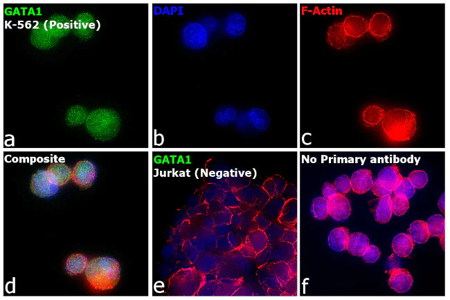 Immunocytochemistry/ Immunofluorescence - Anti-GATA1 antibody [RP23040007] (AB308028)