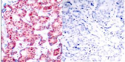 Immunohistochemistry (Formalin/PFA-fixed paraffin-embedded sections) - Anti-GATA1 (phospho S142) antibody (AB28816), expandable thumbnail