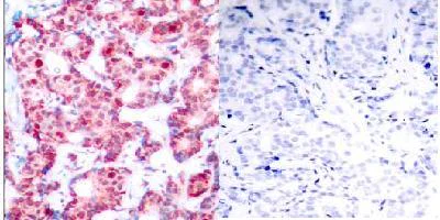 Immunohistochemistry (Formalin/PFA-fixed paraffin-embedded sections) - Anti-GATA1 (phospho S142) antibody (AB28816)