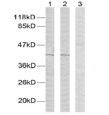 Western blot - Anti-GATA1 (phospho S142) antibody (AB28816)