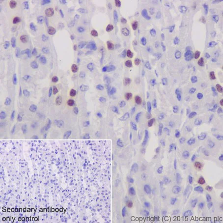 Immunohistochemistry (Formalin/PFA-fixed paraffin-embedded sections) - Anti-GATA2 + GATA3 antibody [EPR17874] (AB182747)